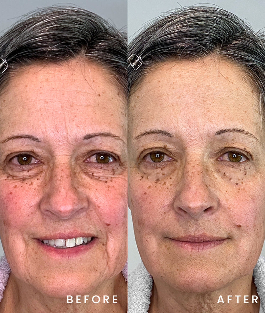 Age Defying Clean System