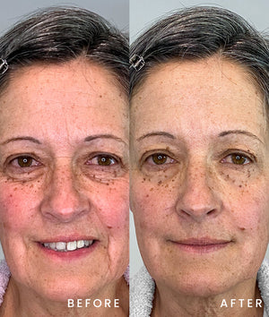 Age-Defying Clean Skincare System || 3 Step